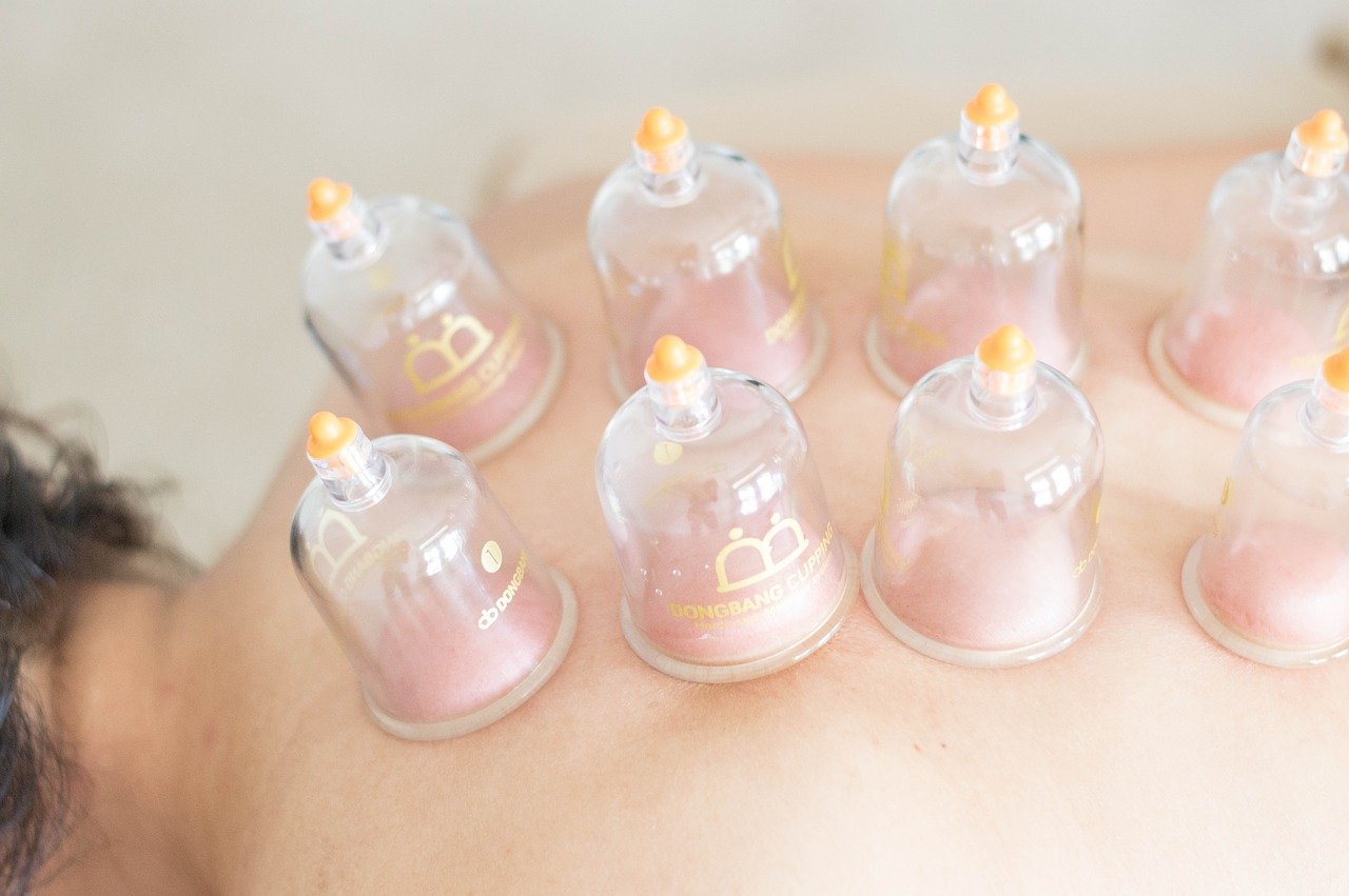 Cups voor cupping massage